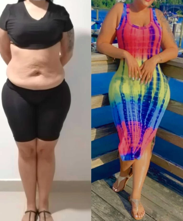 How Much Does a Mommy Makeover Cost? What You Need to Know Before Your Transformation